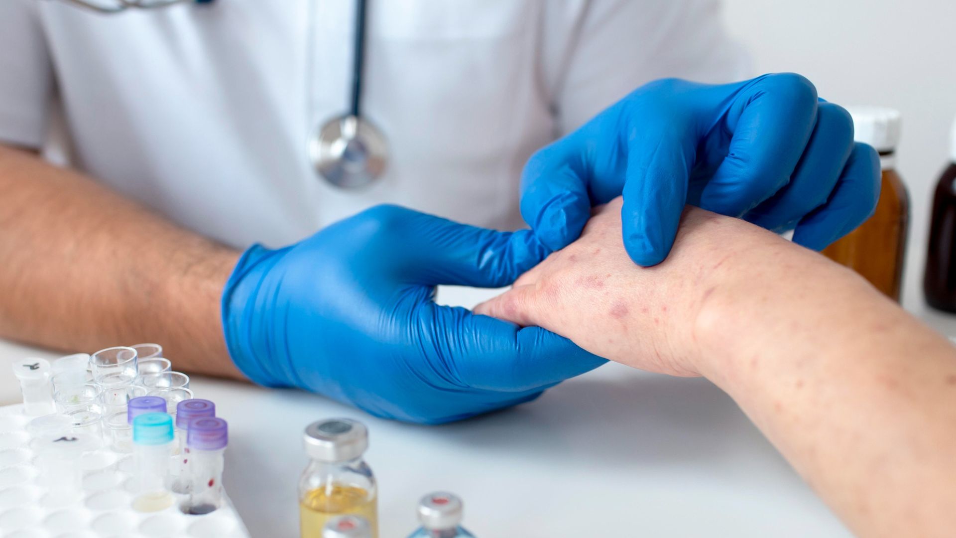 Alerta sanitaria en Florida por aumento de casos de Lepra - Foto de referencia de freepik