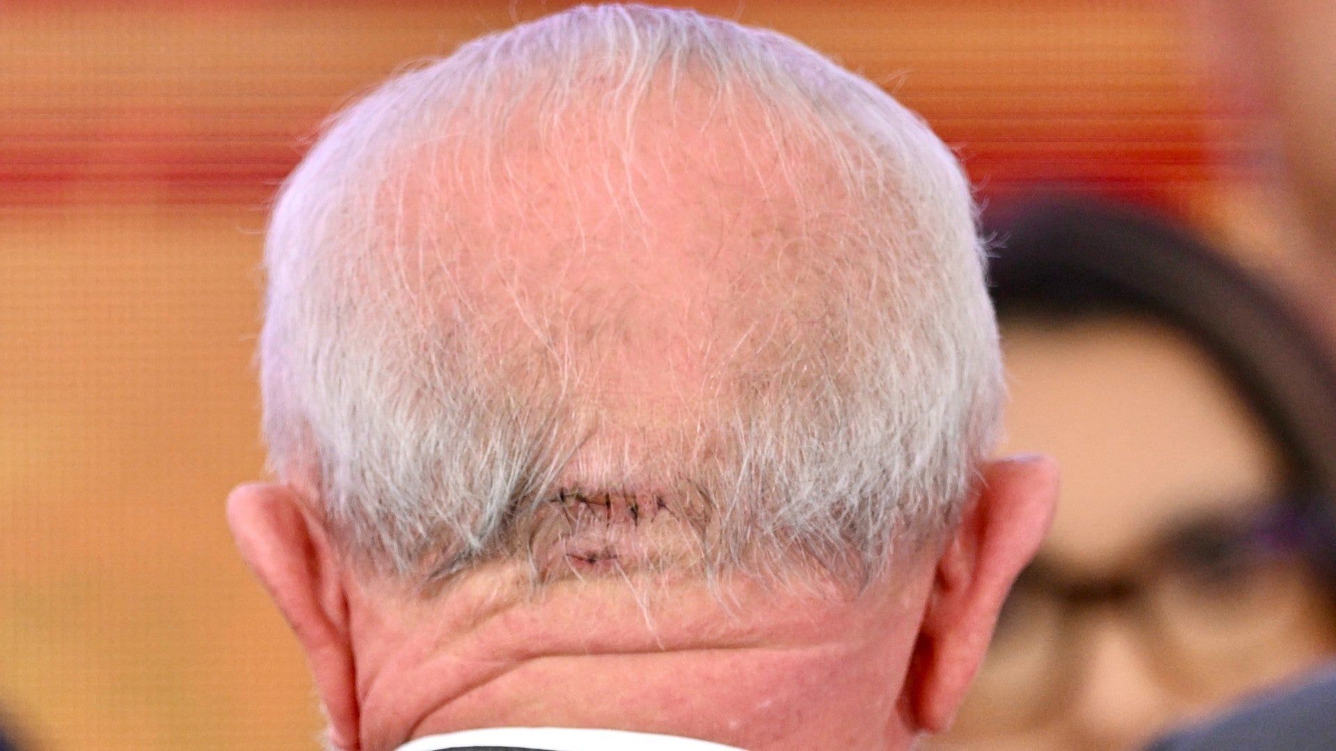 Lula da Silva se somete a estudios médicos tras el golpe en la nuca Lula da Silva se somete a estudios médicos tras el golpe en la nuca