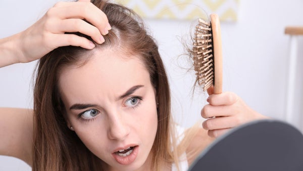 Si eres mujer y pierdes mucho cabello puedes estar sufriendo de alopecia, estas son las causas de este síntoma que va en aumento Si eres mujer y pierdes mucho cabello puedes estar sufriendo de alopecia, estas son las causas de este síntoma que va en aumento