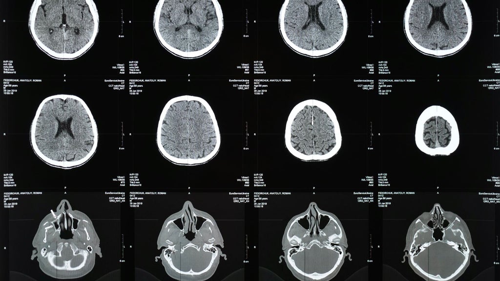 Se podría revivir memorias después de morir | Foto Canva