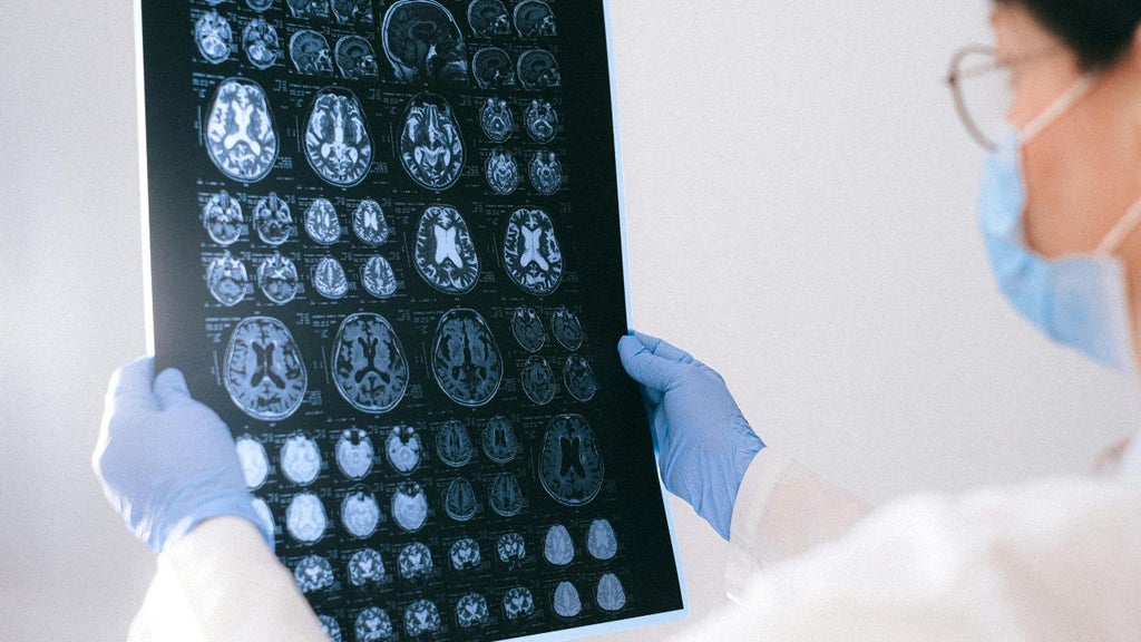 La pandemia provocó el aumento del envejecimiento cerebral prematuro - Foto referencia: Canva