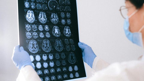 La pandemia provocó el aumento del envejecimiento cerebral prematuro - Foto referencia: Canva