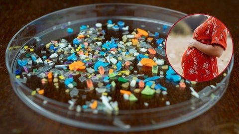 Presencia de microplásticos en la placenta - Fotos referencia: Canva