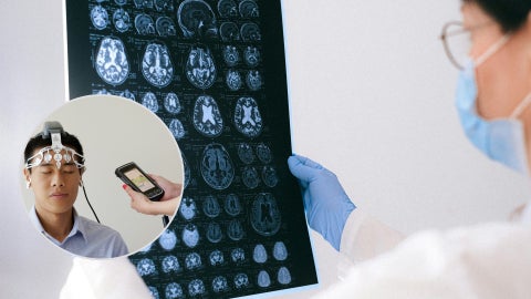 Habla por primera vez la persona que recibió implante de chip cerebral - Fotos referencia: Canva
