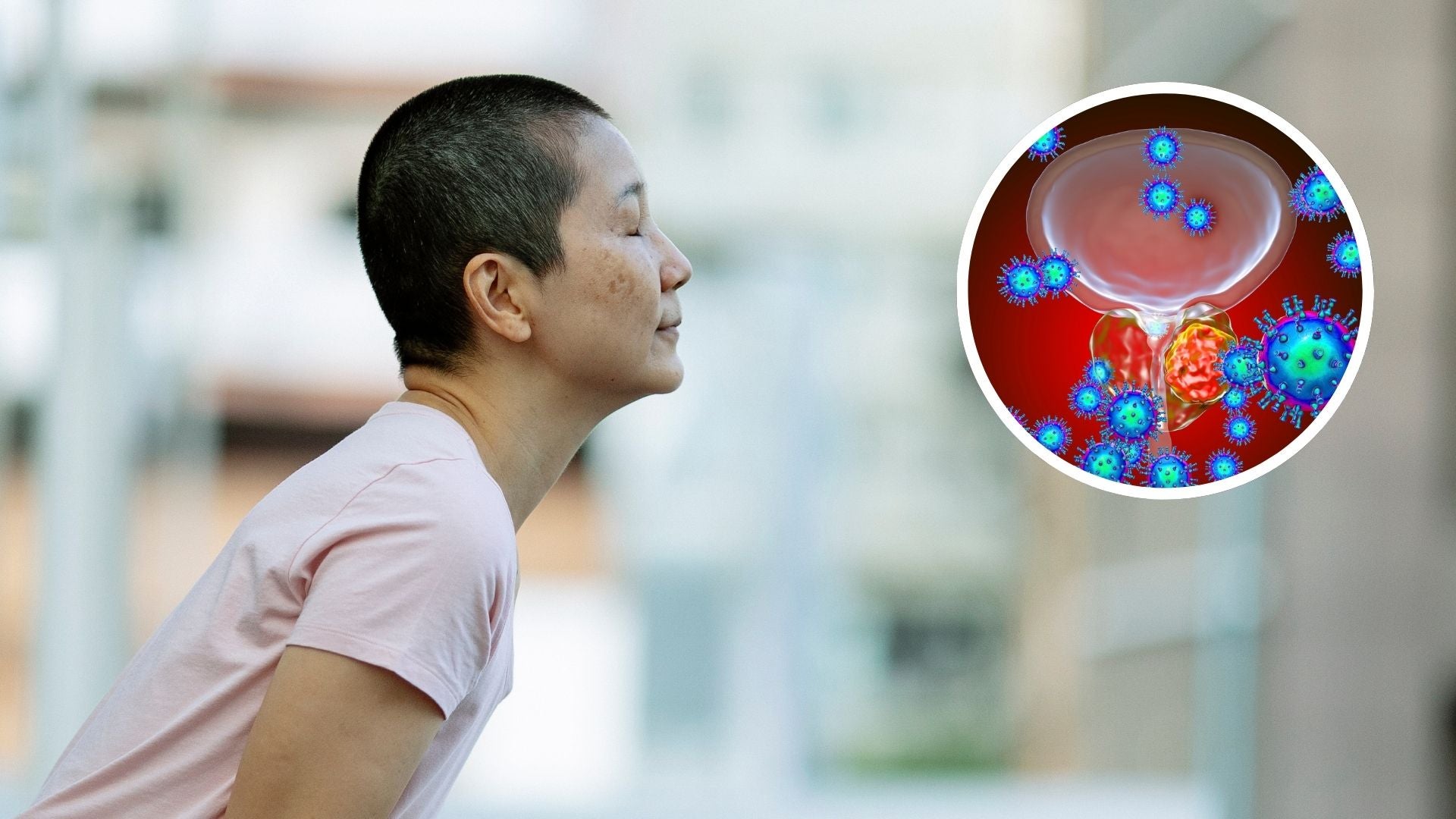 El cáncer de vejiga es una enfermedad agresiva | Foto Canva El cáncer de vejiga es una enfermedad agresiva | Foto Canva
