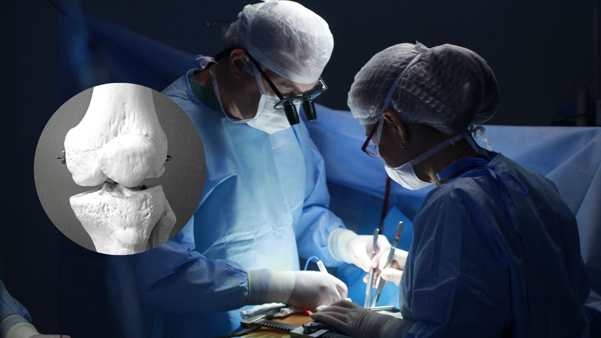 Dispositivo 3D promete revolucionar las cirugías ortopédicas - Fotos referencia: Canva