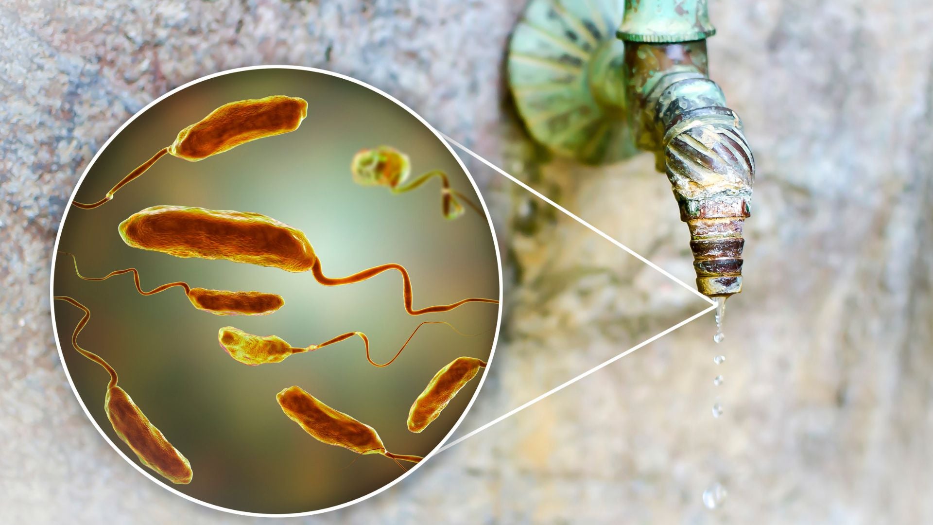 Los índices de muertes por cólera aumentaron en un 50 %, según la OMS - Foto referencia: Canva