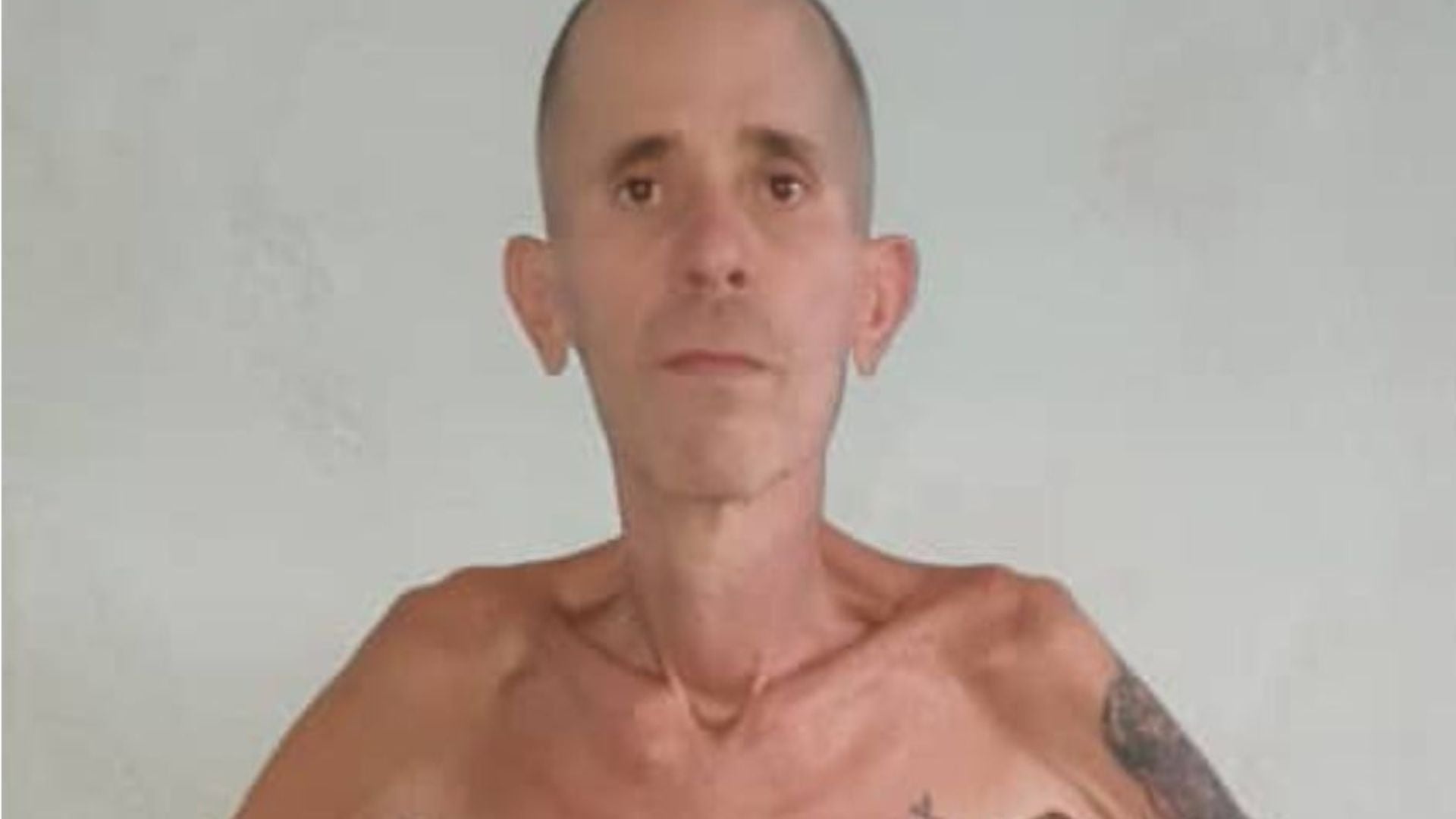 Alexander Díaz, exprisionero político venezolano gravemente enfermo - Foto: NTN24