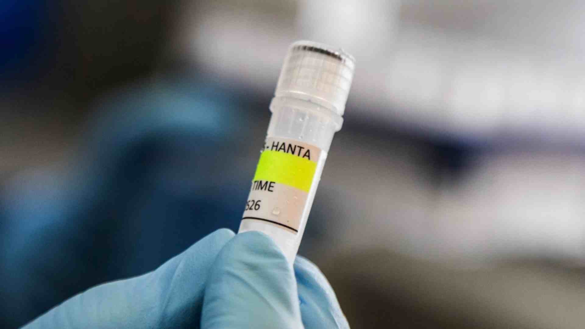 Casos de hantavirus - AFP