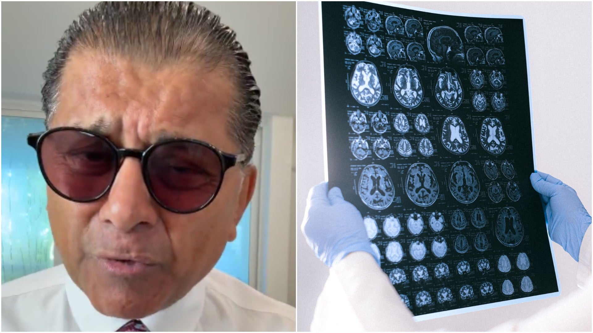 Franklin Virgüez, actor venezolano / Médico revisando escaneos de un cerebro en un entorno clínico - Fotos de referencia: Instagram / Pexels