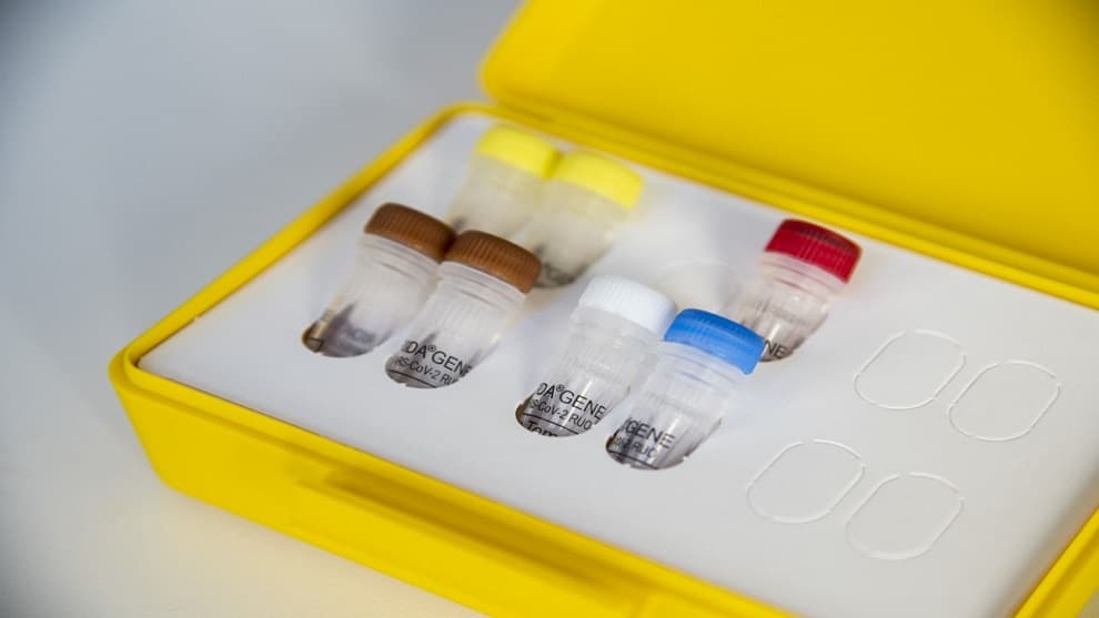 Dos muertes por coronavirus en Venezuela este viernes