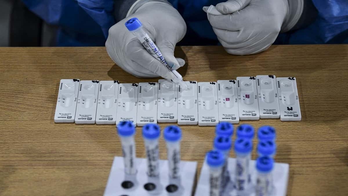 Argentina registró un récord de 20.870 casos diarios de covid-19