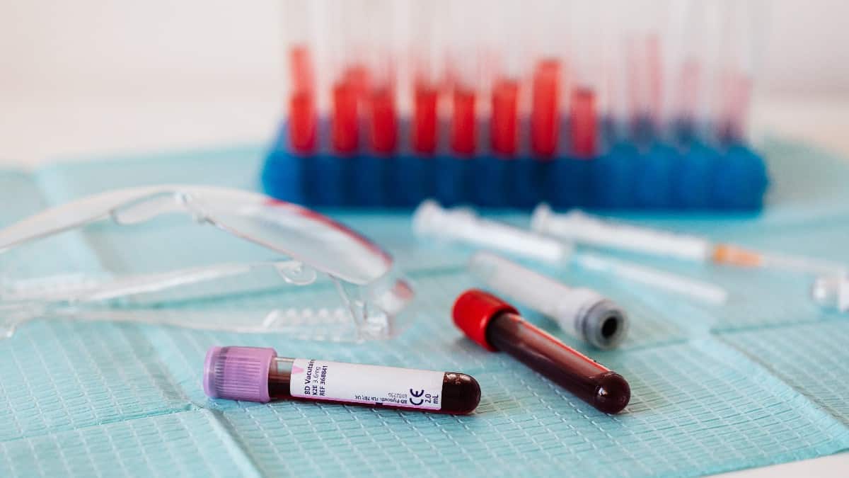 Foto tomada de: (pexels.com/es-es) Investigadores advierten sobre los riesgos del "lavado de sangre" para personas con covid-19 prolongado