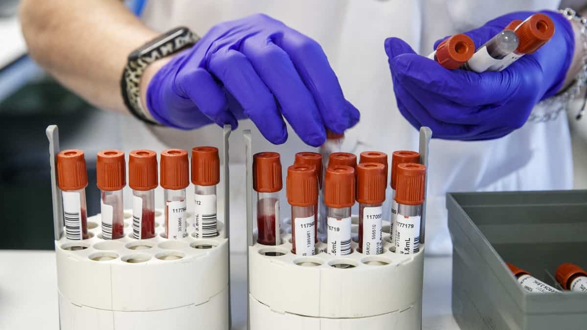 ¿El covid-19 nació en un laboratorio?