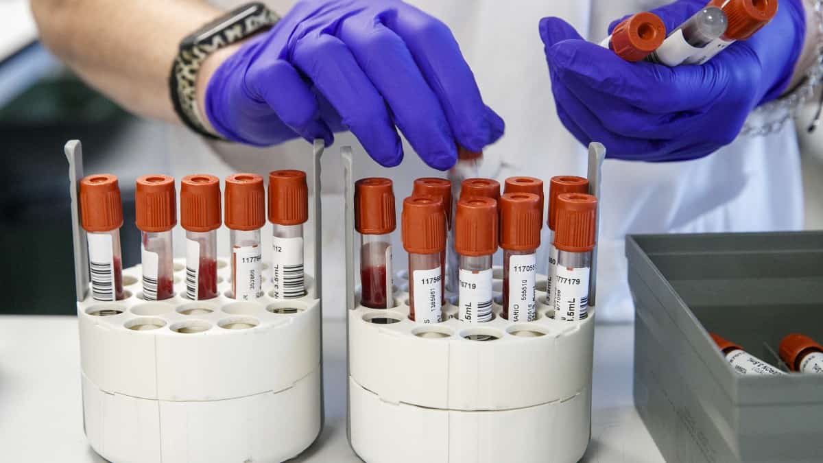 Paciente con VIH se curó luego de 15 años sin recibir ningún tratamiento