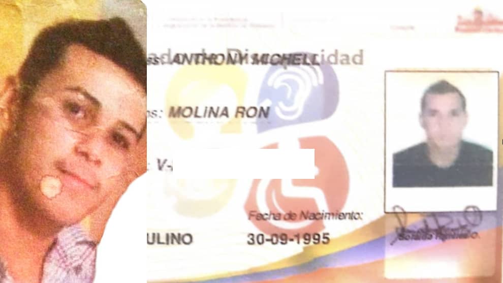 Denuncian detención y "tratos degradantes" contra joven con discapacidad mental