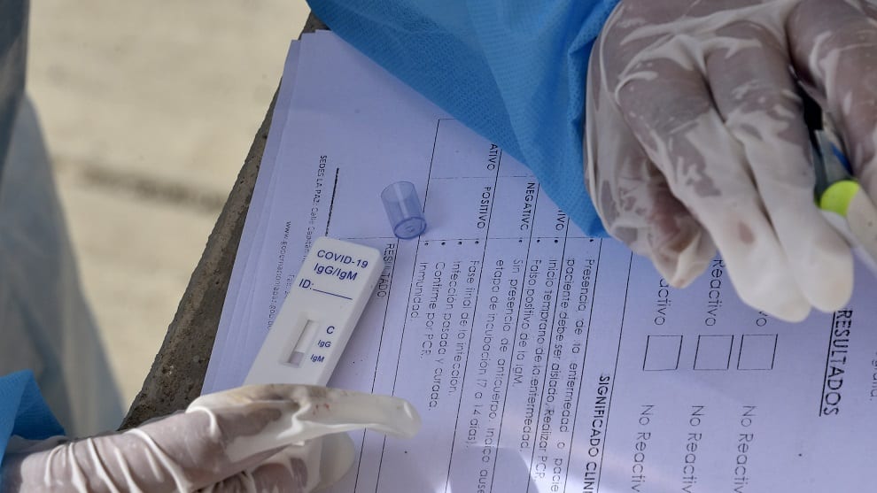 Bolivia producirá fármaco ruso usado como tratamiento contra el covid-19