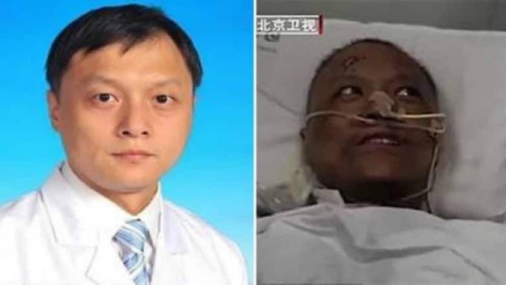 Tratamiento para médicos con coronavirus en China oscureció su piel