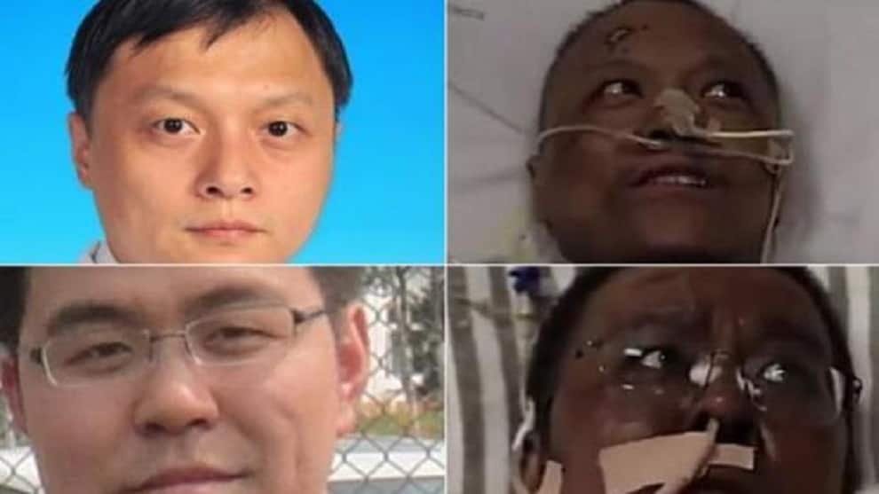 Falleció un médico que sufrió cambio de color en su piel tras superar el COVID-19
