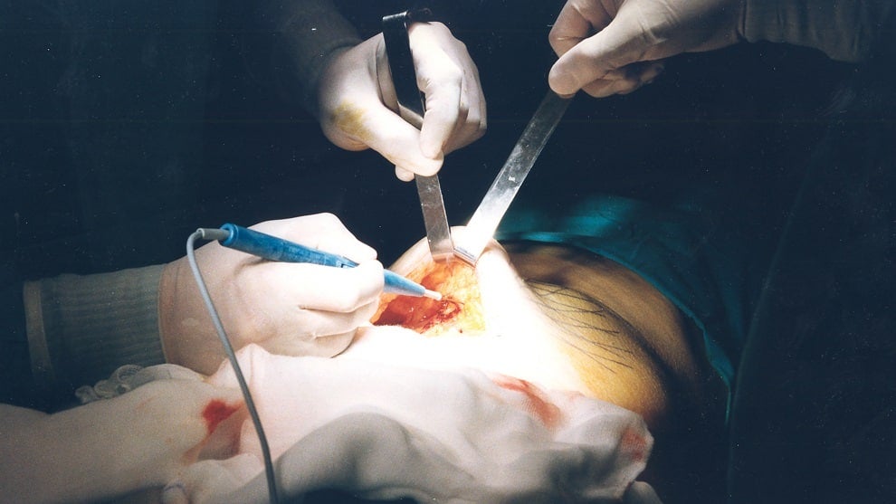 Cirugías estéticas/ Foto: EFE