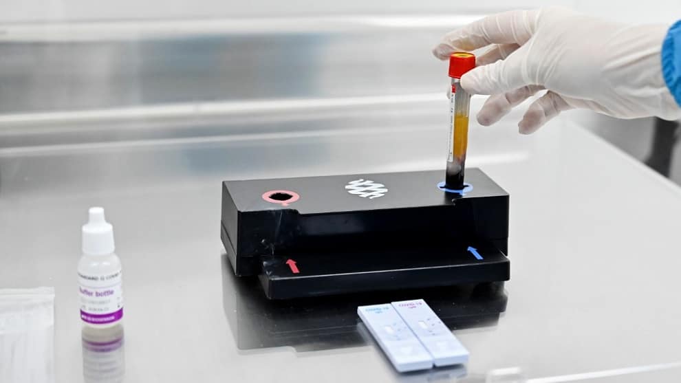 Alcaldía de Bogotá hace pruebas para COVID-19 en sectores de alto riesgo