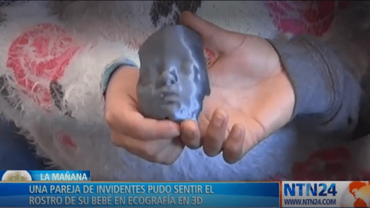Ecografía 3D