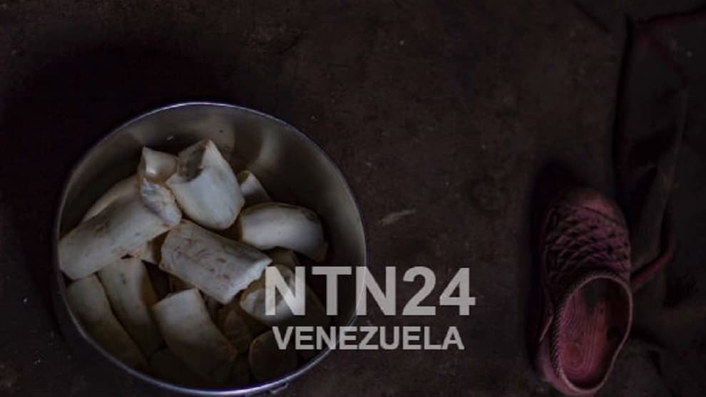 malnutrición-Venezuela