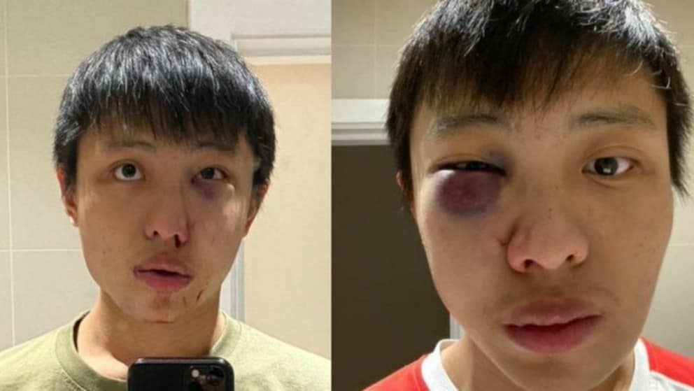 "No quiero tu coronavirus en mi país": ataque racista a asiático en Londres