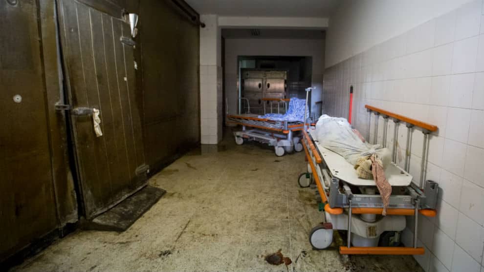 Hombre muere de apendicitis