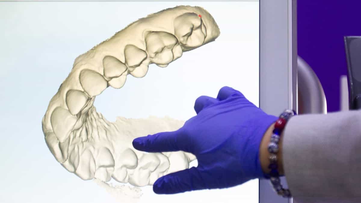 ¡Insólito! Dientes humanos caen sobre trabajador de una tienda en EE.UU.