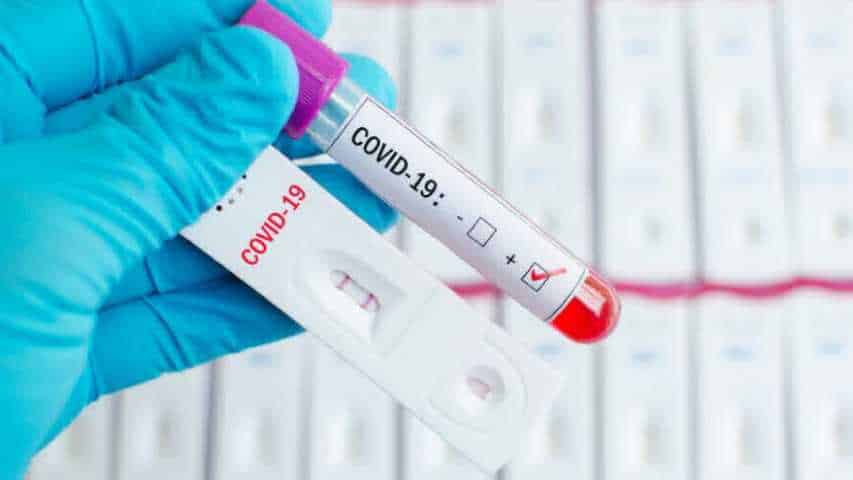 Pruebas despistaje | Foto: Cortesía