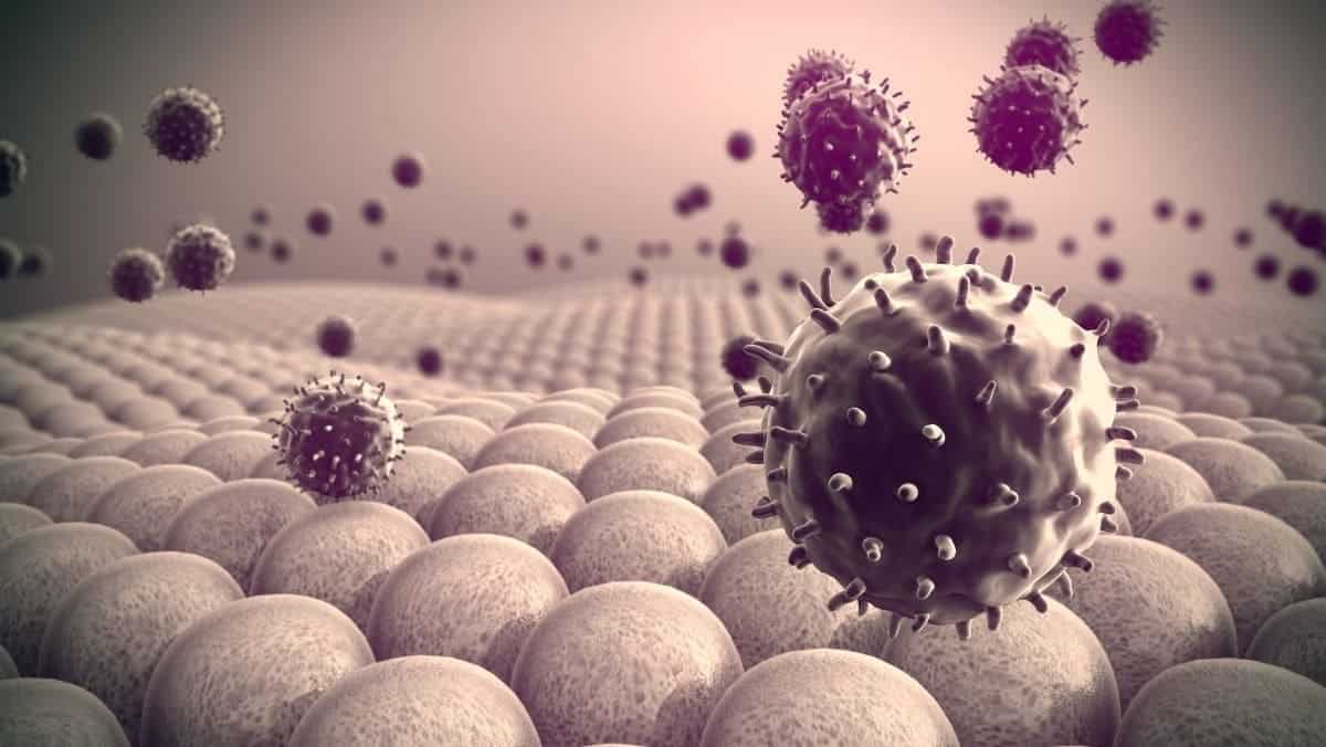 Foto referencial tomada de Internet